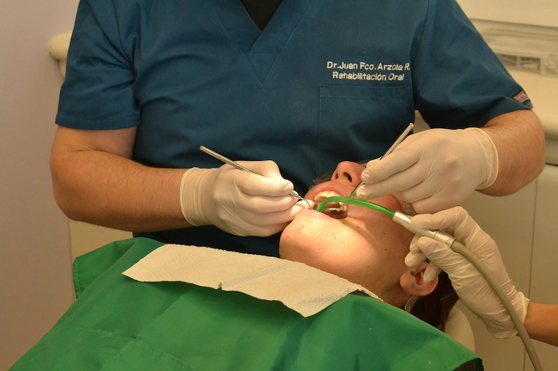 Oral Surgery Extraction